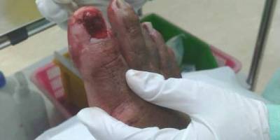Semoga Cepat Sembuh Tn Presiden KPPKKSM